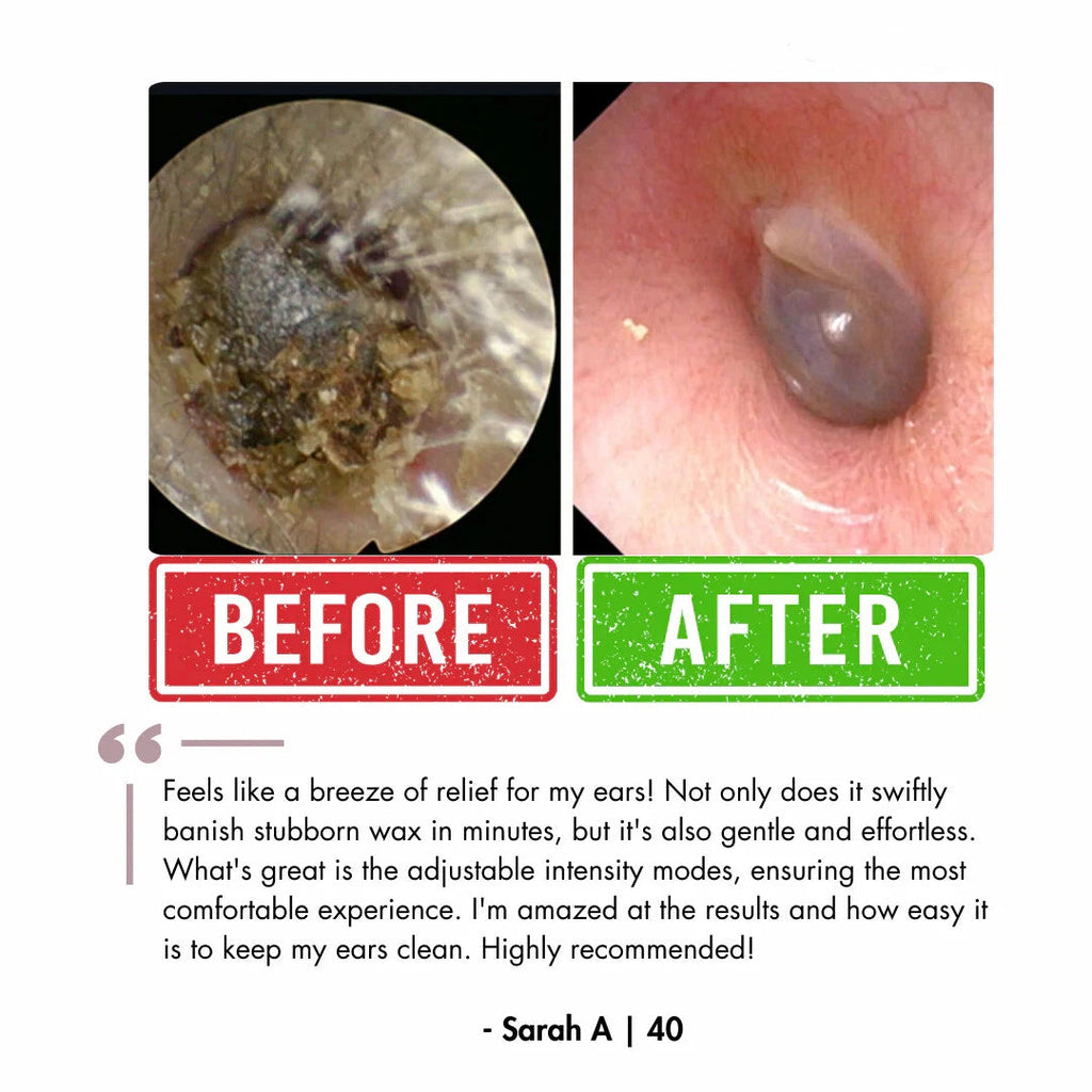 Electric Ear Wax Removal Kit with LED Display