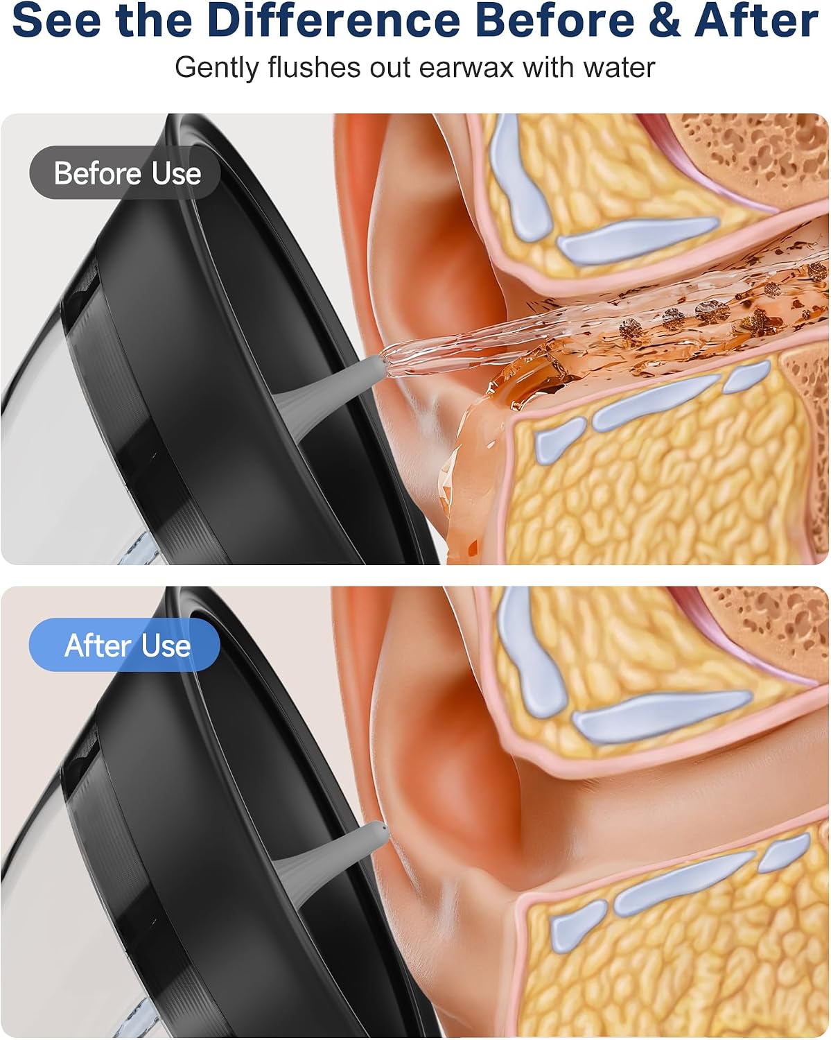 Renergy Ear Wax Removal, Water Temp Sensor, Ear Irrigation Flushing System