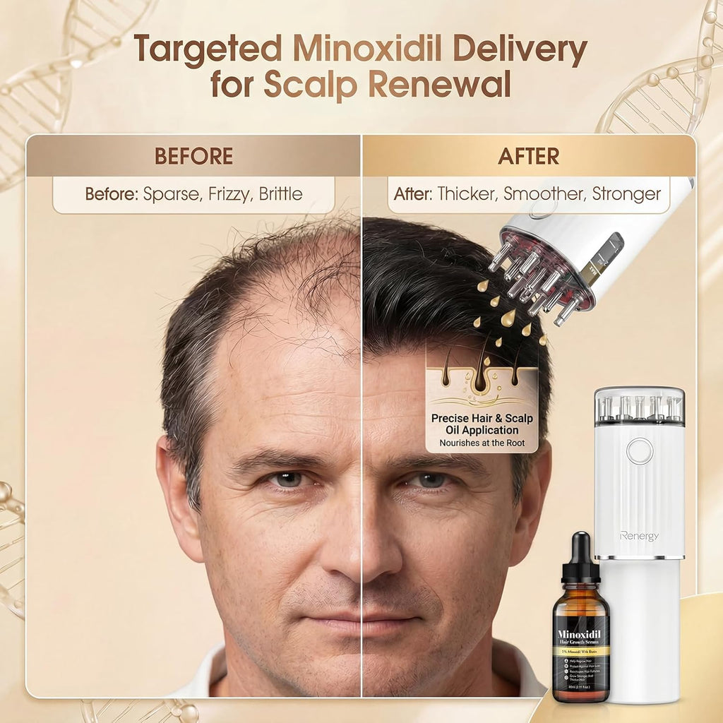 Renergy Electric Hair Oil Applicator for Scalp, Red Light Therapy Direct Brush with Vibration & Microcurrent, Minoxidil Applicator Tool, Serum Dispenser, Electric Scalp Massager Comb for Hair Growth